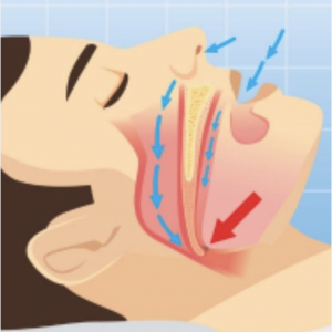 Nessuna immagine impostata 